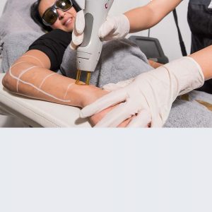 changelaserclinic-prijslijst-gentle-lase-pro-laser-behandeling
